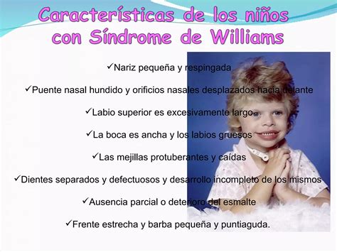 Sindrome De William Med Uide Ppt