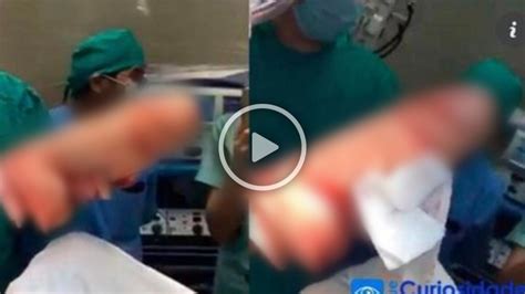 Fue Al Hospital Por Un Intenso Dolor Abdominal Lo Operaron Y Los