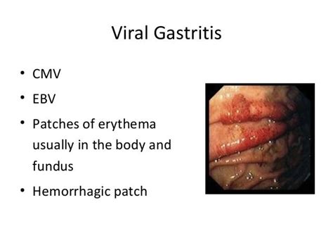 Gastritis