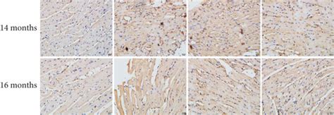 Mir P Overexpression Reduced Mcmv Induced Expression Of The Nlrp