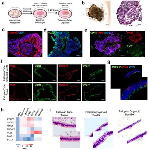 Development And Characterization Of An IPSC Derived Fallopian Tube