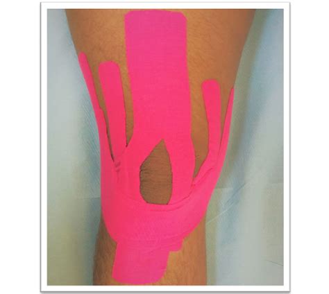 A view of the completed Kinesio taping (KT) application on the right ...