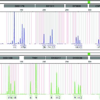 PDF Importance Of Y STR Profiling In Sexual Assault Cases With Mixed