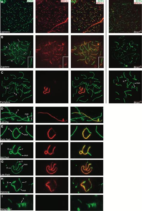 Brca1 Histone H2ax Phosphorylation And Male Meiotic Sex Chromosome Inactivation Current Biology