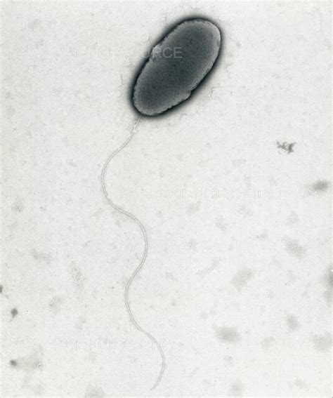 Photograph Pseudomonas Aeruginosa Science Source Images