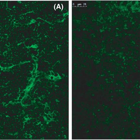 Immunofluorescence Staining Revealing The Expression Of Hβ2m In Hla‐a30