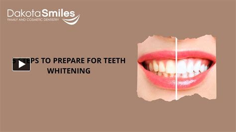 Ppt Top Steps To Prepare For Teeth Whitening Powerpoint