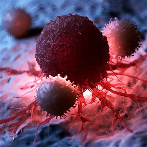 oncology bengalfaith