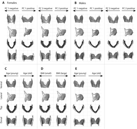 Warped Thyroid Cartilage Images Showing Shape Variation Within Females Download Scientific