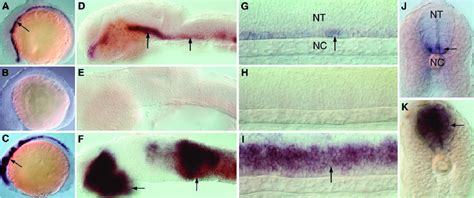 In Situ Hybridization Analysis Of Aw777717 A C Expression In The