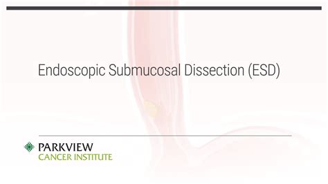 Endoscopic Submucosal Dissection Esd Youtube