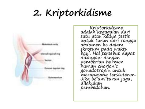 Kelainan Dan Penyakit Pada Sistem Reproduksi Ppt