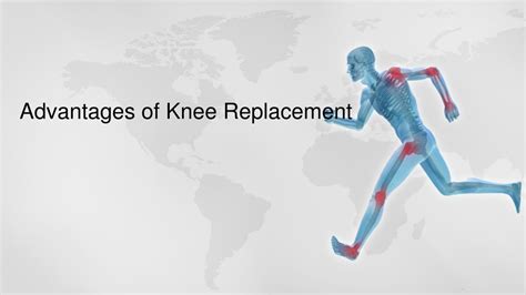 PPT Advantages Of Knee Replacement PowerPoint Presentation Free