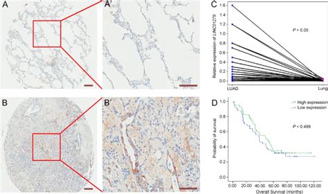 Suppression Of The Long Non Coding Rna Linc Triggers Autophagy And