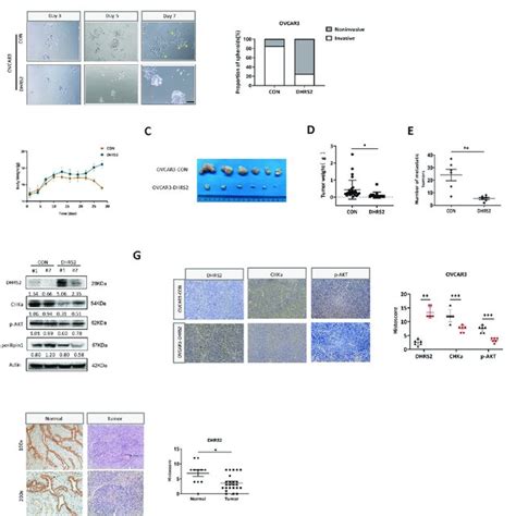 DHRS2 Hampers The Invasion And Metastasis Of OC Cells A Representative