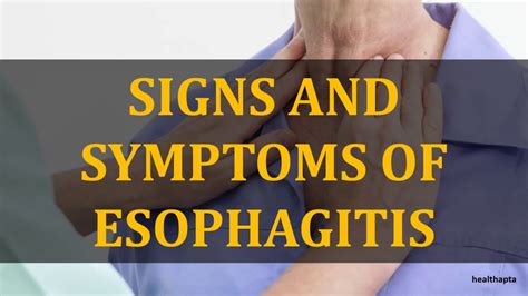 SIGNS AND SYMPTOMS OF ESOPHAGITIS YouTube