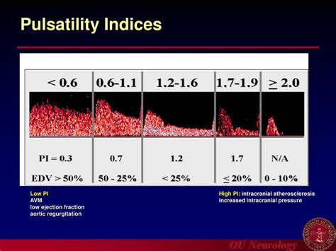 Ppt Introduction To Carotid Ultrasound And Transcranial Doppler