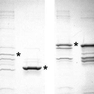 A Schematic Representation Of Recombinant Ac Constructs The Top