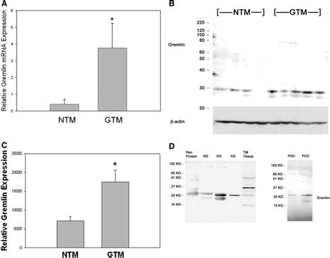 Expression Of Gremlin Mrna And Protein In Normal And Glaucomatous Human