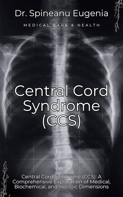 Central Cord Syndrome Ccs A Comprehensive Exploration Of Medical