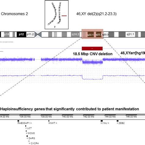 Gbanded Chromosomes And Array CGH Analysis Highresolution