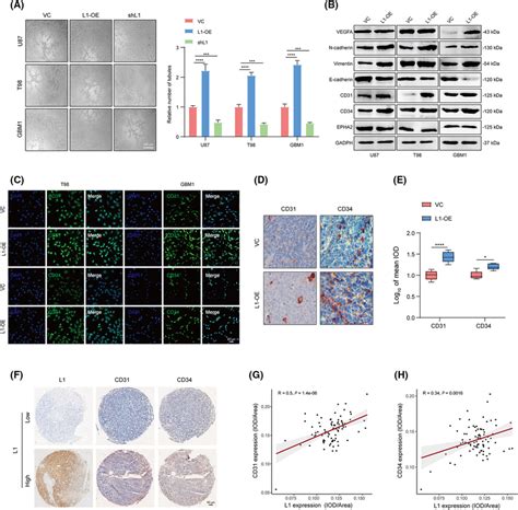 L Overexpression Promotes Vm Formation By Glioma Cells A