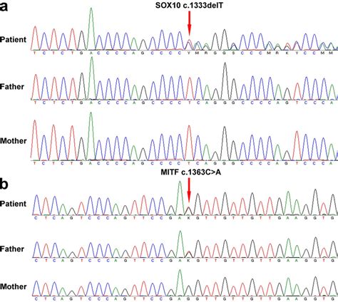 Identification Of A Novel Sox10 Heterozygous Deletion Mutation Download Scientific Diagram