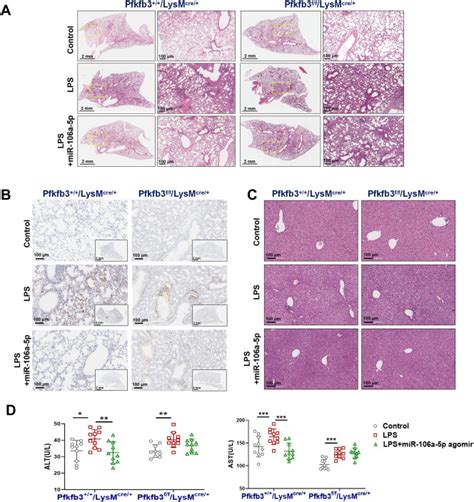 Mir 106a 5p Targets Pfkfb3 And Improves Sepsis Through Regulating