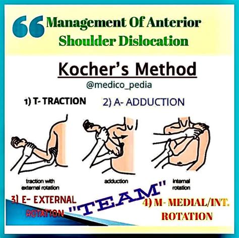 Kochers Method Team Traction External Rotation Adduction Medial