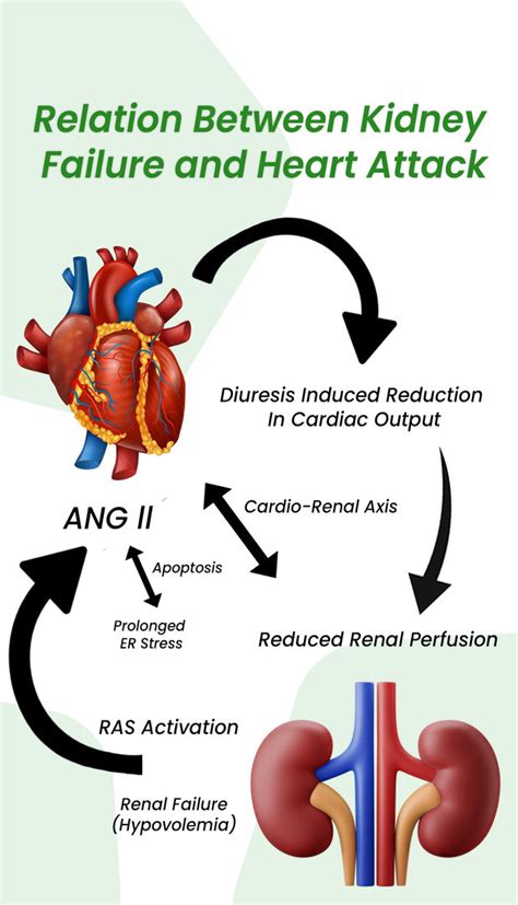 Kidney Failure after Heart Attack: Know the Facts in Details | ClinicSpots