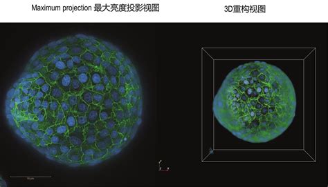 高内涵成像分析系统用于类器官蛋白表达分析 —bio 101