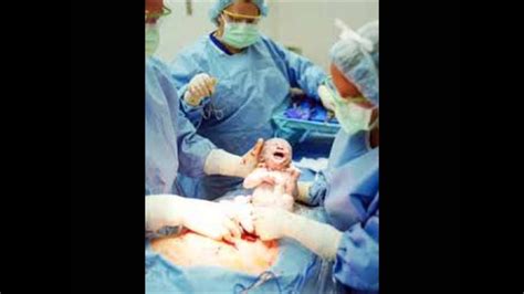 Video Tetano Neonatal Youtube