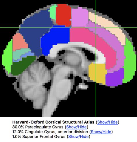 FMRI Tutorial 9 ROI Analysis Andy S Brain Book 1 0 Documentation