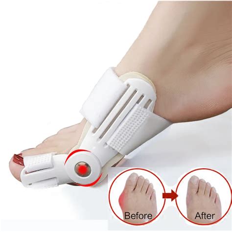 Bunion Device Hallux Valgus Orthopedic Braces Toe Correction Night Feet