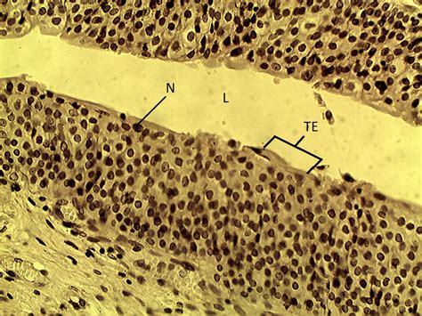 Transitional Epithelium Histology