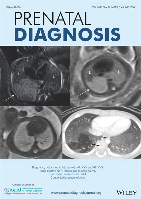 Prenatal Diagnosis Of Functionally Univentricular Heart Associations