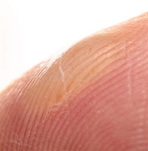 Corn On A Finger Isolated On A White B Stock Photo Image Of Closeup