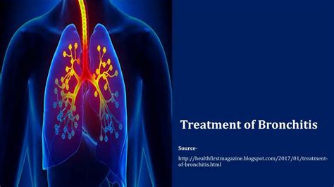 Ppt Treatment Of Bronchitis Powerpoint Presentation Free Download