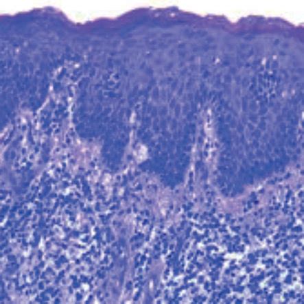 (a) Histology and (b) immunohistochemistry of a representative SS... | Download Scientific Diagram