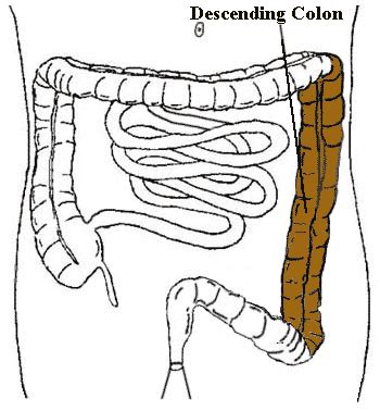 Descending colon - Location, Function, Disorders and Pictures