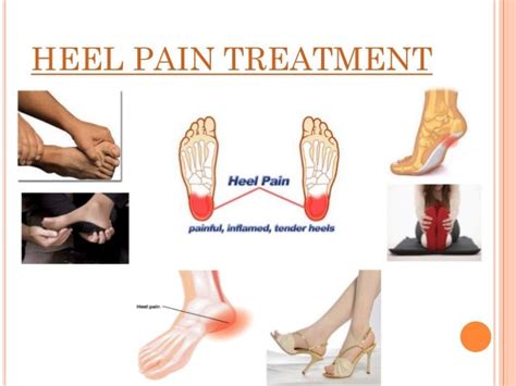 Heel pain treatment