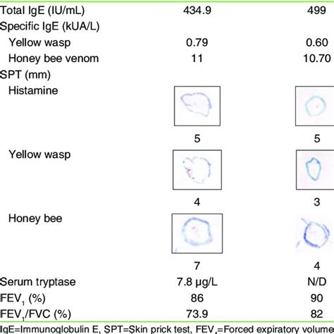 Clinical Characteristics With Skin Prick Test Specific Immunoglobulin