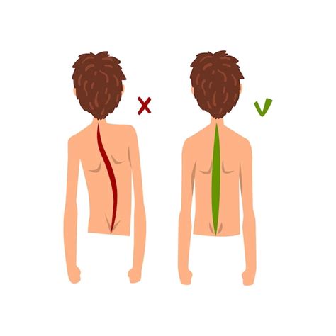 Postura Correcta E Incorrecta De La Columna Vertebral Vector De Vista