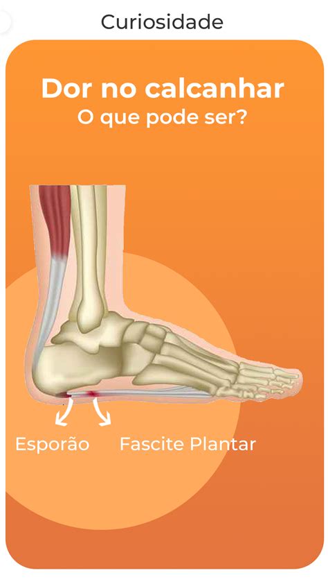 O Que Pode Ser A Dor No Calcanhar Dor No Calcanhar Exerc Cios De