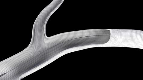 Flow diverter stent in aneurysm 3D model | CGTrader