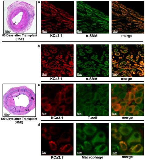 Double Fluorescent Immunostaining For Kca And Sma T Cells Cd