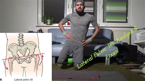 Lateral Pelvic Tilt How To Self Correct Uneven Hips Analyse Stretch