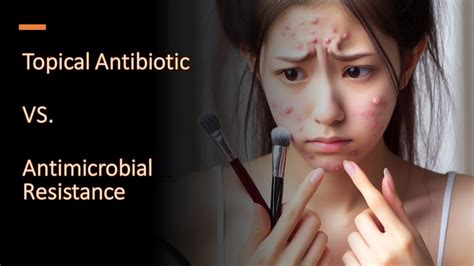 Balancing Acne Treatment And Antibiotic Resistance Youtube