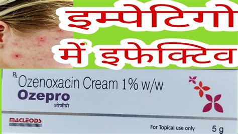 Ozepro Cream Uses In Hindi Ozenoxacin Cream Uses In Hindi YouTube