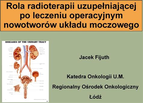 Rola Radioterapii Uzupe Niaj Cej Po Leczeniu Operacyjnym Nowotwor W